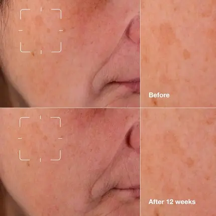 Сыворотка Clinique Even Better Clinical Dark Spot Clearing Serum с витамином С