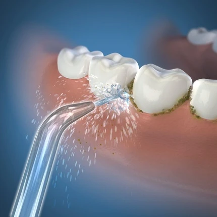 Сменные насадки Waterpik