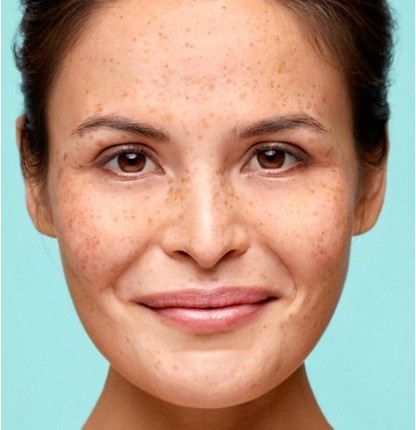 Сыворотка Biodermal Anti Age Facial Serum