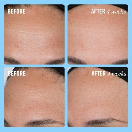 Крем First Aid Beauty Укрепляющий коллагеновый крем с коллагеном, пептидами и ниацинамидом