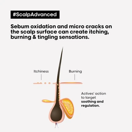 Набор для ухода за кожей головы L'Oreal Professional Scalp Advanced Anti-Discomfort Box