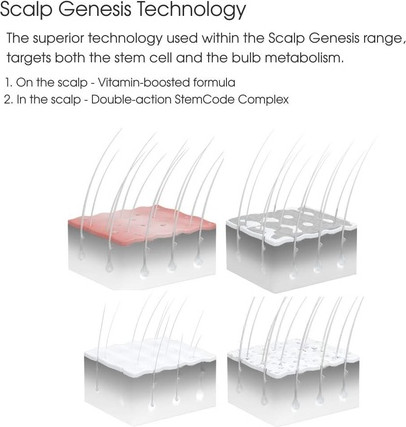 Сыворотка Schwarzkopf Scalp Genesis