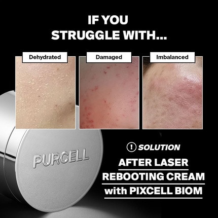 Крем для лица Purcell Pixcell Biom After Laser Rebooting Cream для восстановления пробиотического барьера