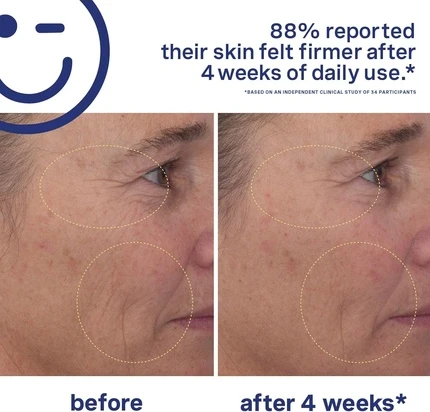 Антивозрастная сыворотка Kate Somerville Mega-A Skin Transforming Anti-Aging Serum с ретиналем