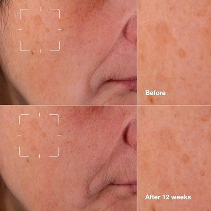 Сыворотка Clinique Even Better Clinical Dark Spot Clearing Serum с витамином С