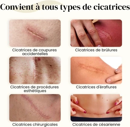 Гель Dermatix Acne