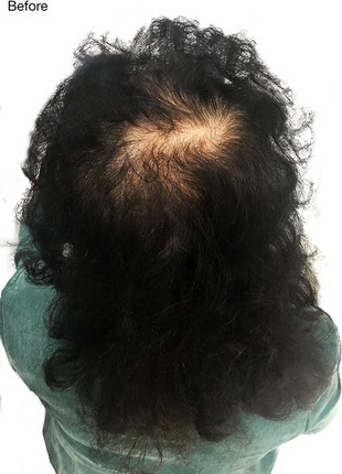 Волокна для густоты волос Nanogen Hair Thickening Fibres