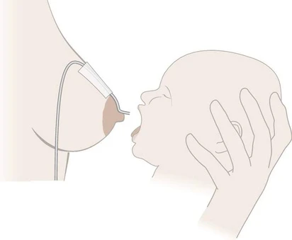 Система для кормления Medela
